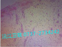 各類(lèi)炎性細(xì)胞